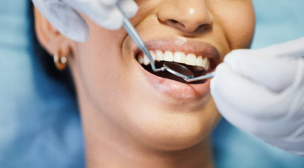 Best Pediatric Emergency Dentist in Citrus, CA
