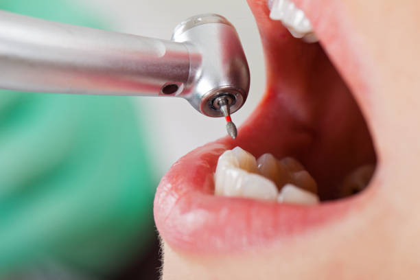 Best Emergency Dentist for Knocked-Out Tooth in Citrus, CA